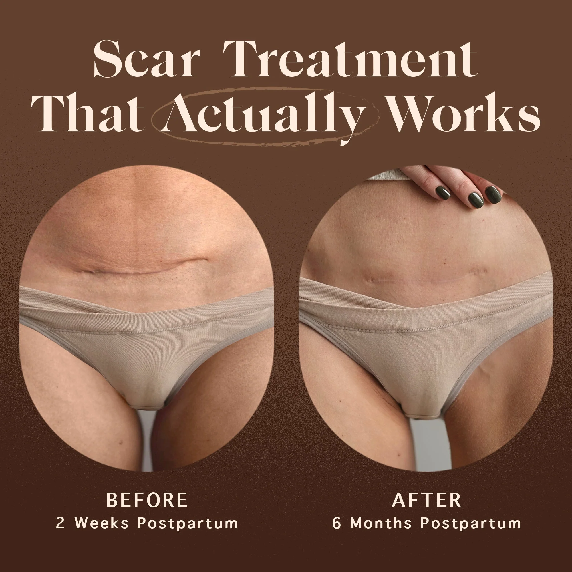 Restorative Scar Treatment - Image 3